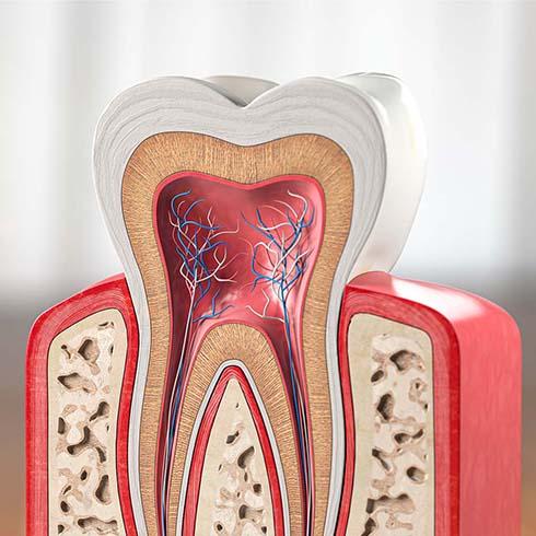 Endodontics in Lower Sackville