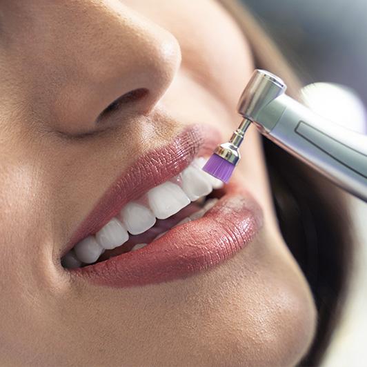 Oral Hygiene/Cleaning in Lower Sackville